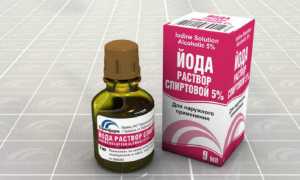 Чем отстирать одежду или постельное белье от йода после его высыхания в домашних условиях?