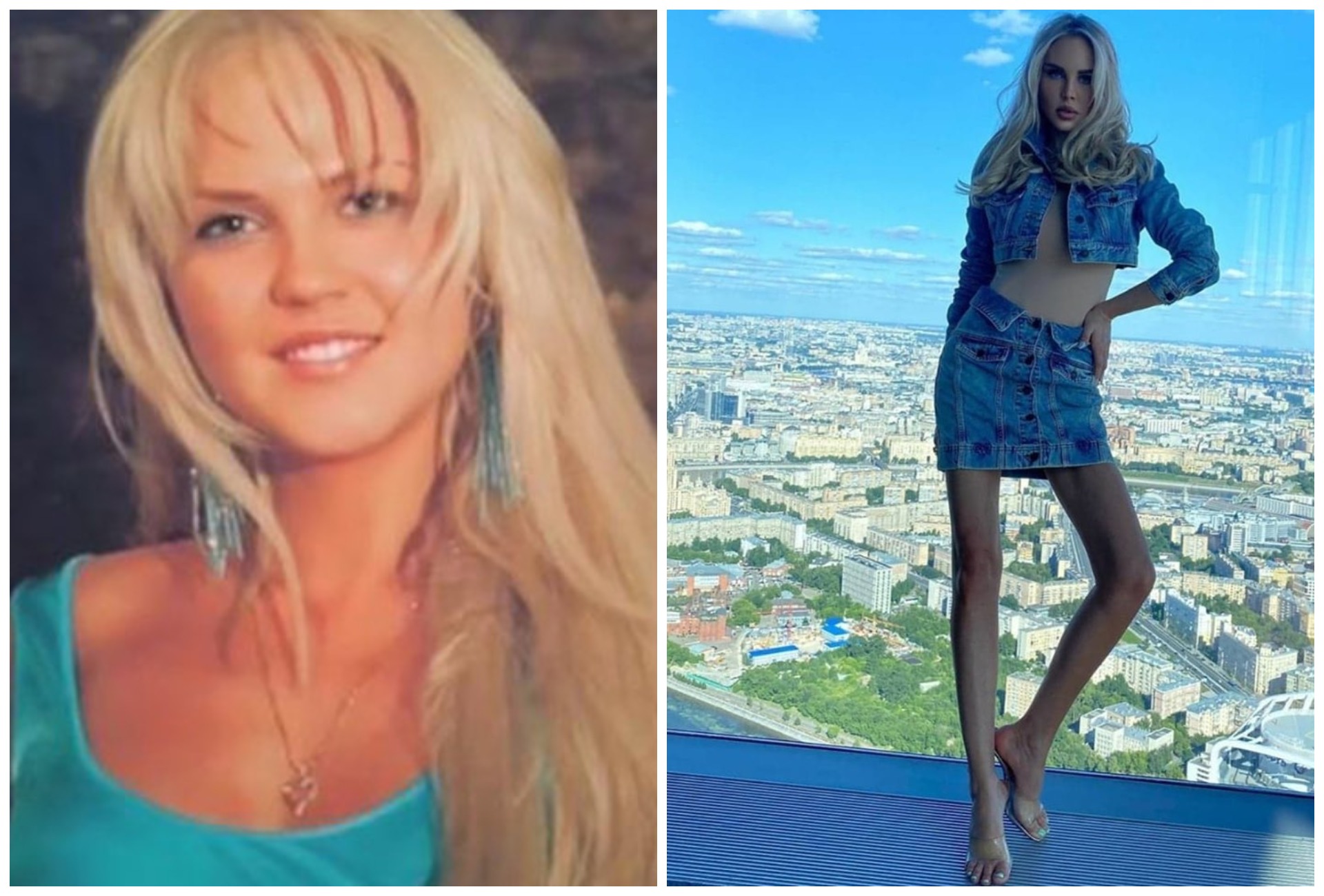 знаменитости которые переборщили с похудением