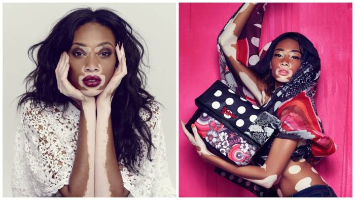 Шантель Браун-Янг